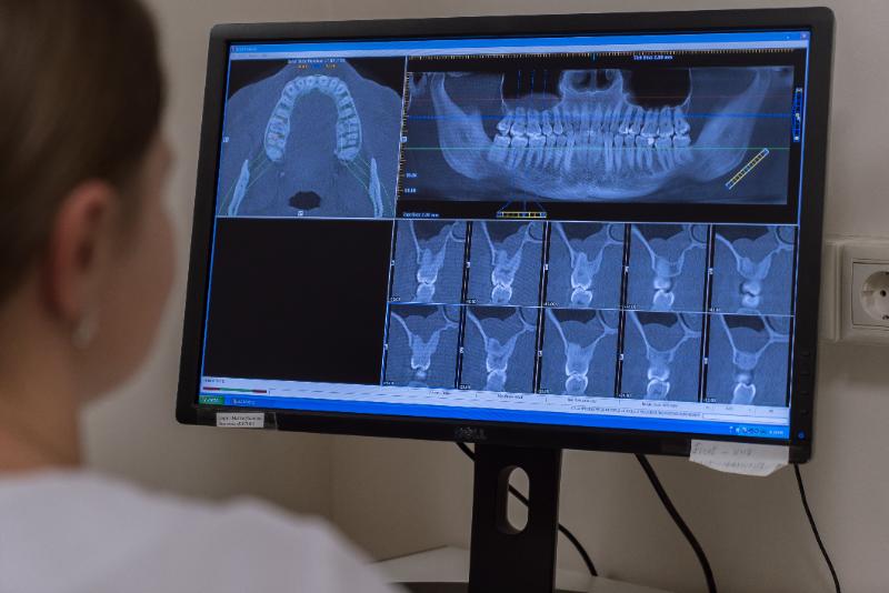 Новые технологии в рентгенологии: от цифровых снимков до 3D-изображений