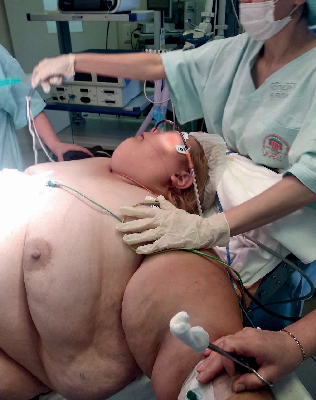 Анестезия при ожирении: полное руководство по рискам и безопасной подготовке