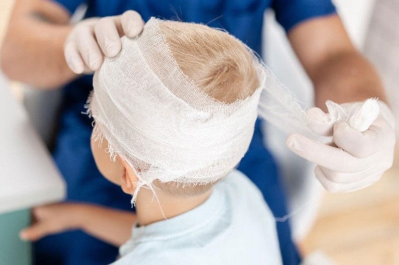 Реанимация при травмах у детей: полное руководство для врачей и родителей