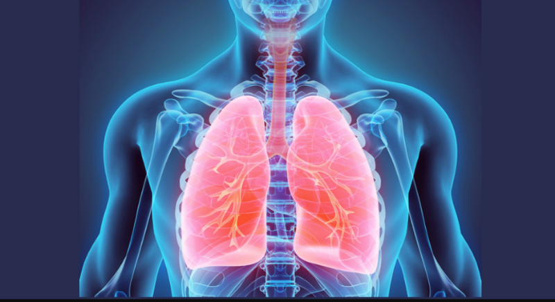 Острая дыхательная недостаточность: полное руководство по спасению жизни