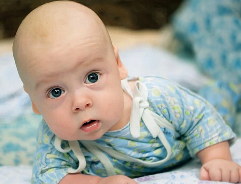 Синдром Веста у детей: обрести понимание и начать правильное лечение