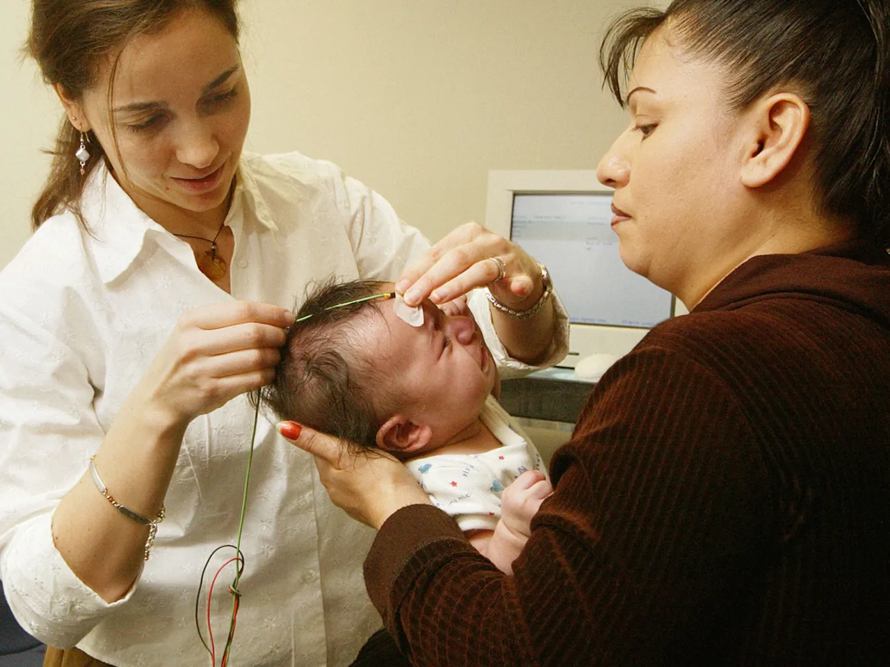 Синдром Леннокса-Гасто: полное руководство для родителей и врачей