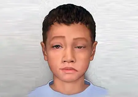 Миастения гравис у детей: обрести контроль над мышечной слабостью