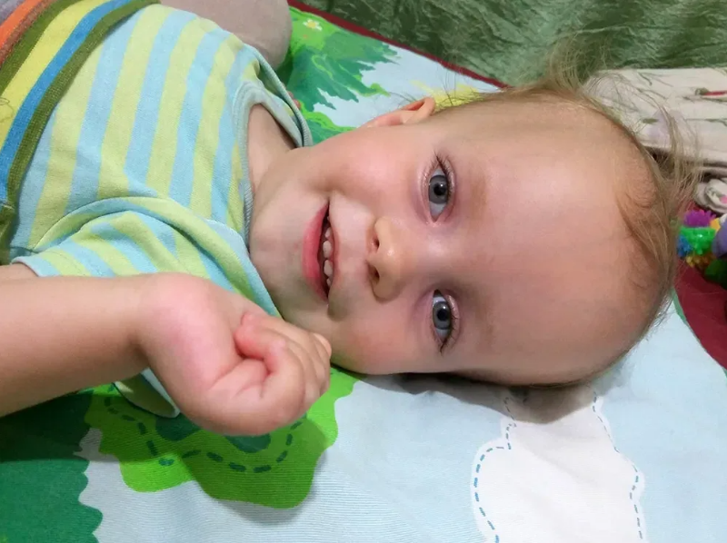 Лейкодистрофии у детей: полное руководство по диагностике и лечению заболевания