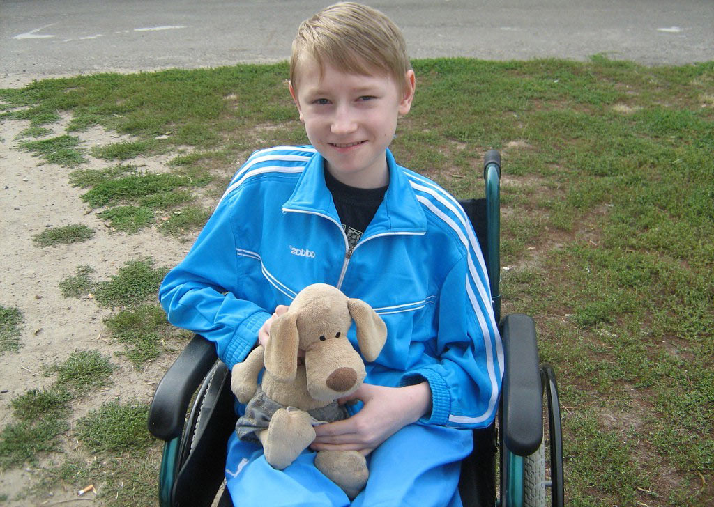 Врожденные миопатии у детей: полное руководство для понимания и помощи ребенку