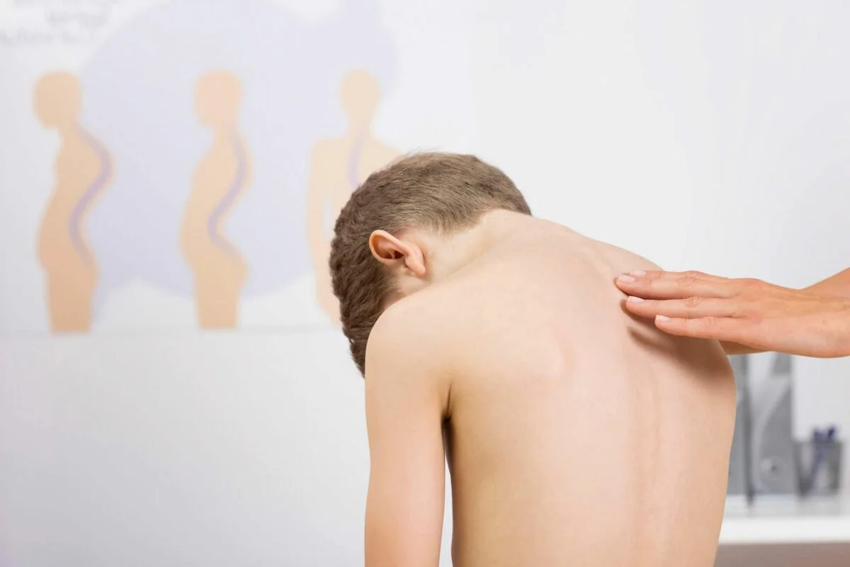 Кифоз у детей и подростков: полное руководство по здоровью детской спины