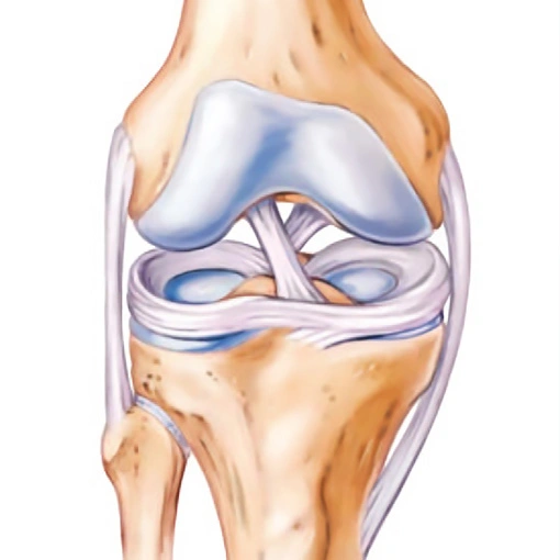 Дискоидный мениск у детей: полное руководство для родителей по лечению