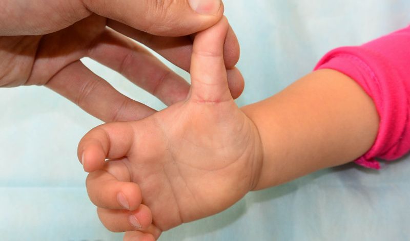 Щелкающий палец у ребенка: найти причину и выбрать безопасное лечение