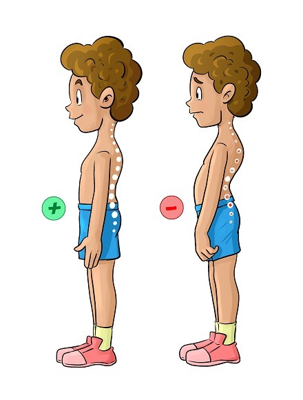 Лордоз у детей: полное руководство по здоровью детского позвоночника