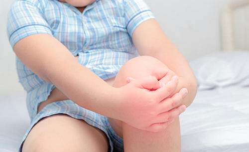 Врожденная контрактура колена у ребенка: от диагноза до полного излечения