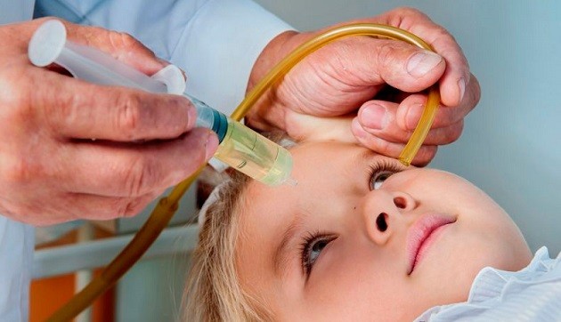 Гайморит у детей: полное руководство по диагностике, лечению и профилактике