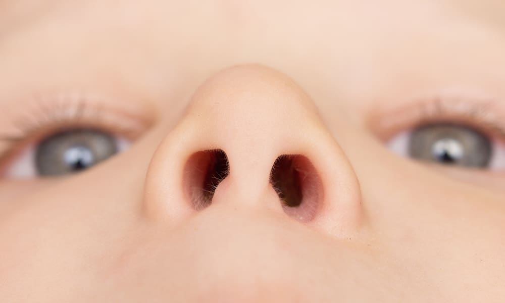 Полипы в носу у ребенка: найти причину и вернуть свободное дыхание