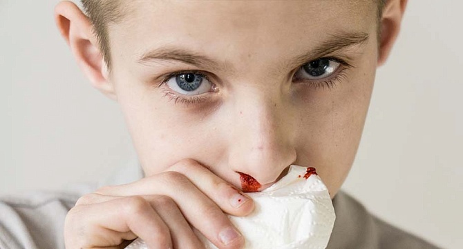 Кровь из носа у ребенка: полное руководство по причинам, помощи и лечению