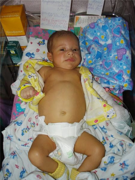 Атрезия желчевыводящих путей у детей: от диагноза к успешному лечению