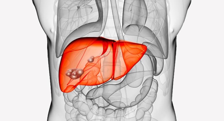 Киста печени у ребенка: от своевременной диагностики до полного выздоровления