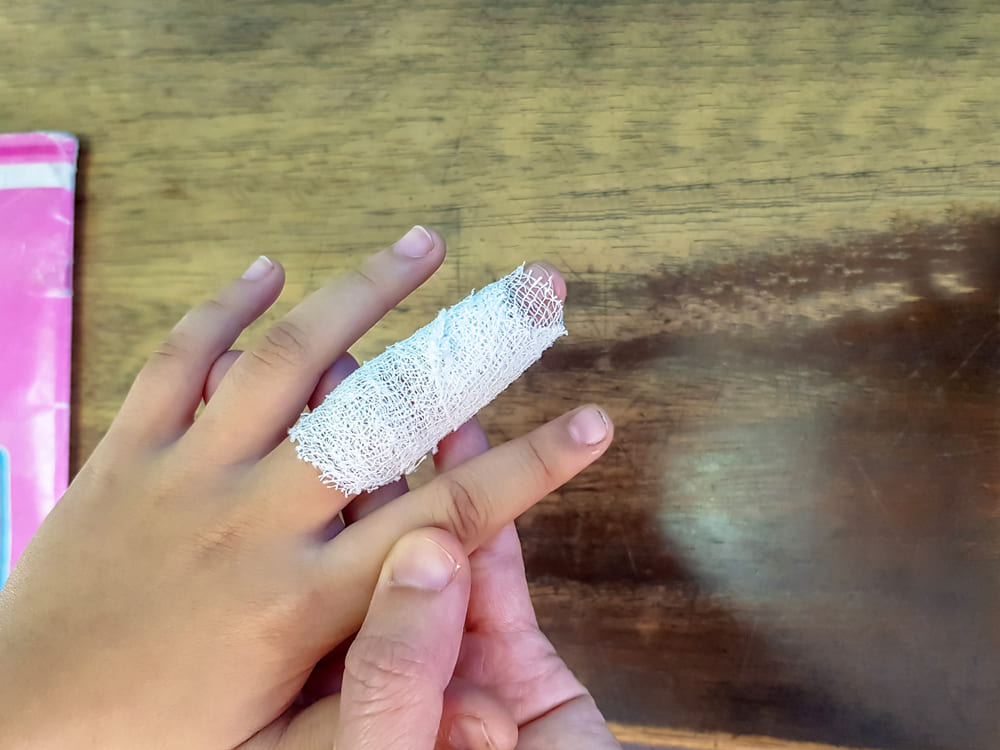 Панариций у ребенка: полное руководство по лечению от детского хирурга