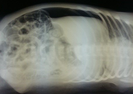 Некротизирующий энтероколит новорожденных: полное руководство для родителей