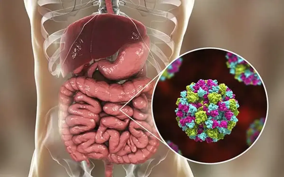 Норовирусная инфекция: полное руководство по симптомам, лечению и защите