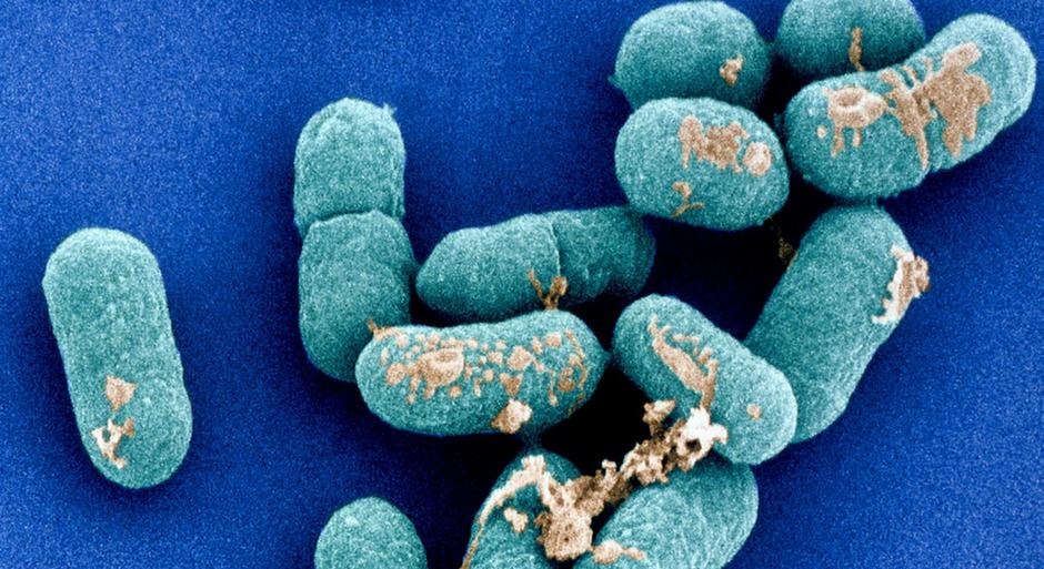 Листериоз: полное руководство по лечению и защите от опасной инфекции