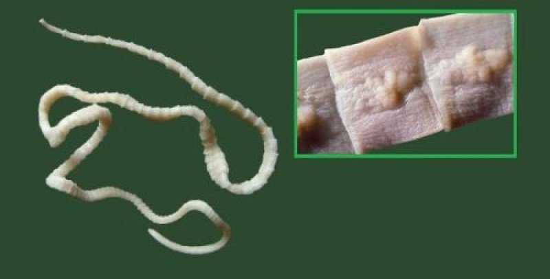 Дифиллоботриоз: полное руководство по лечению и защите от паразита