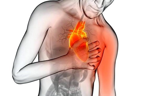 Стенокардия напряжения: контроль симптомов и возвращение к активной жизни