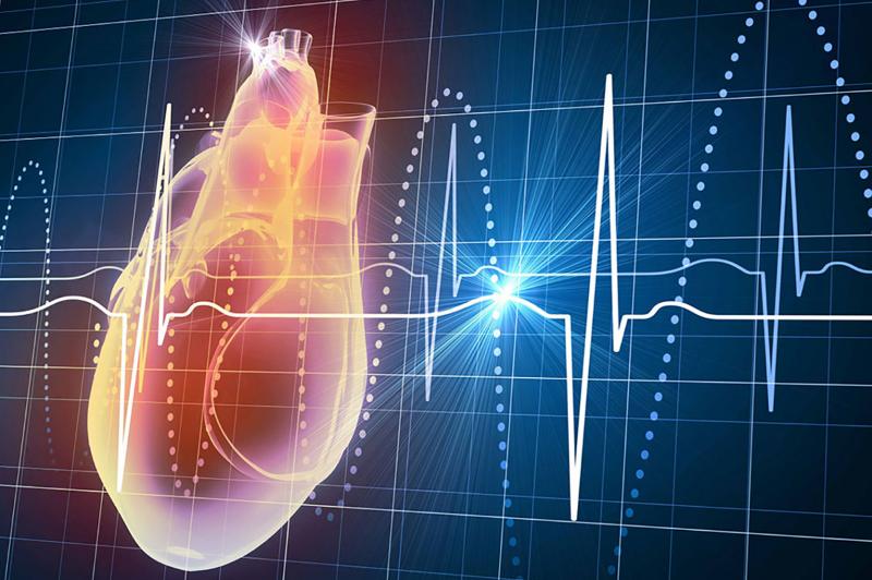 Наджелудочковая тахикардия: обретение контроля над сердечным ритмом