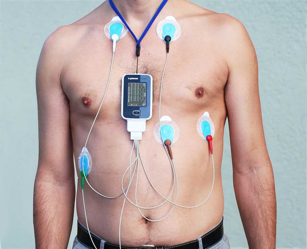 Суточное мониторирование ЭКГ по Холтеру для полной оценки работы сердца