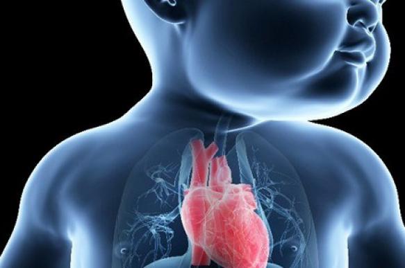 Синдром гипоплазии левых отделов сердца: путь от диагноза до коррекции