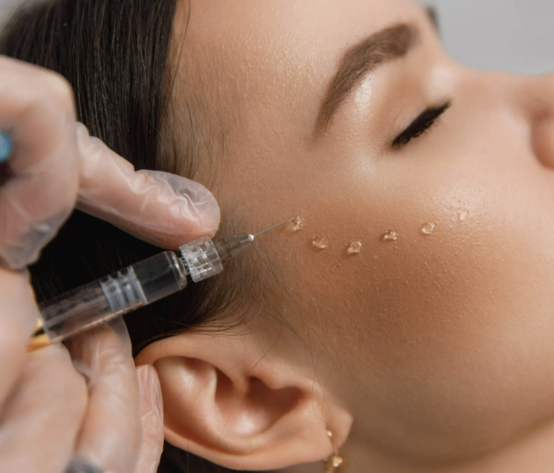 Биоревитализация для омоложения и здоровья кожи: полное руководство косметолога