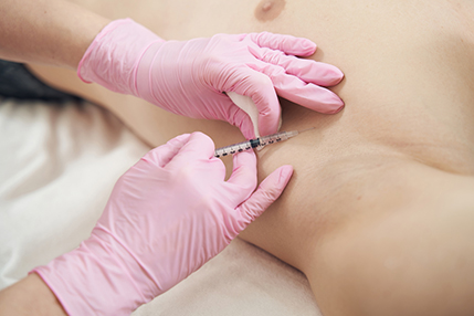 Обрести уверенность и комфорт с современными методами лечения гипергидроза