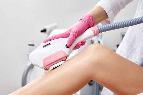 Фотоэпиляция для гладкой кожи: полное руководство по технологии и результатам