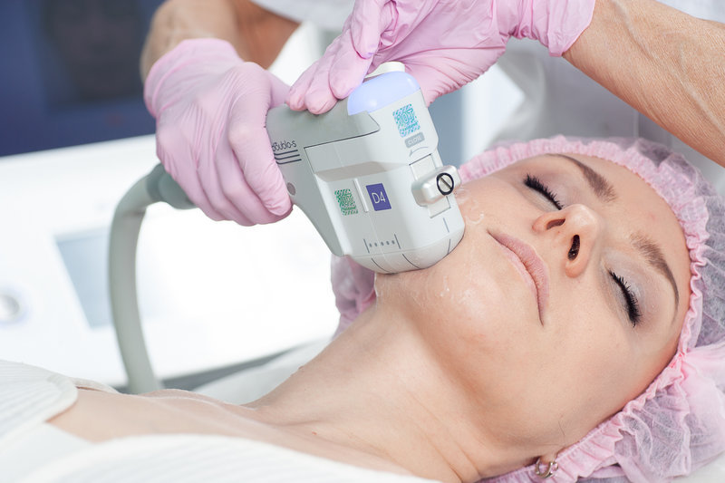 SMAS-лифтинг: полное руководство по безоперационной подтяжке лица