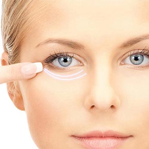 Безоперационная блефаропластика: вернуть молодость взгляду без скальпеля