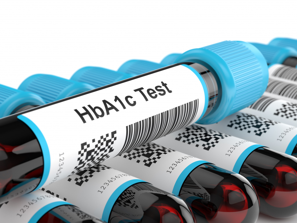 Гликированный гемоглобин (HbA1c): ваш главный показатель контроля диабета