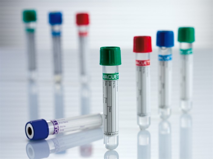 Анализ крови на липазу для оценки здоровья поджелудочной железы