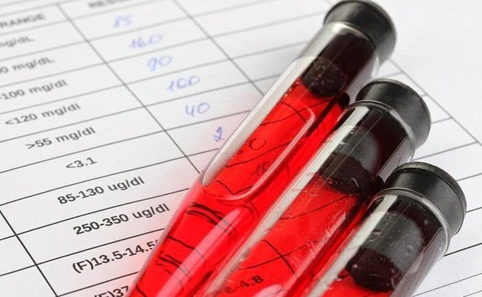 Анализ на антистрептолизин-О (АСЛ-О): полное руководство по маркеру