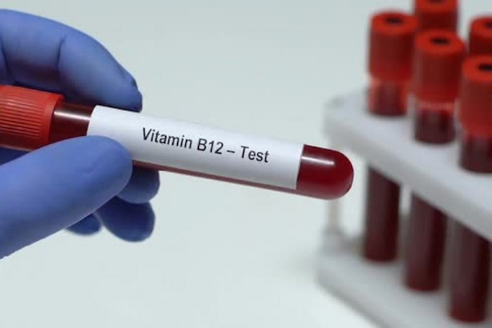 Анализ крови на витамин B12: полное руководство по диагностике дефицита
