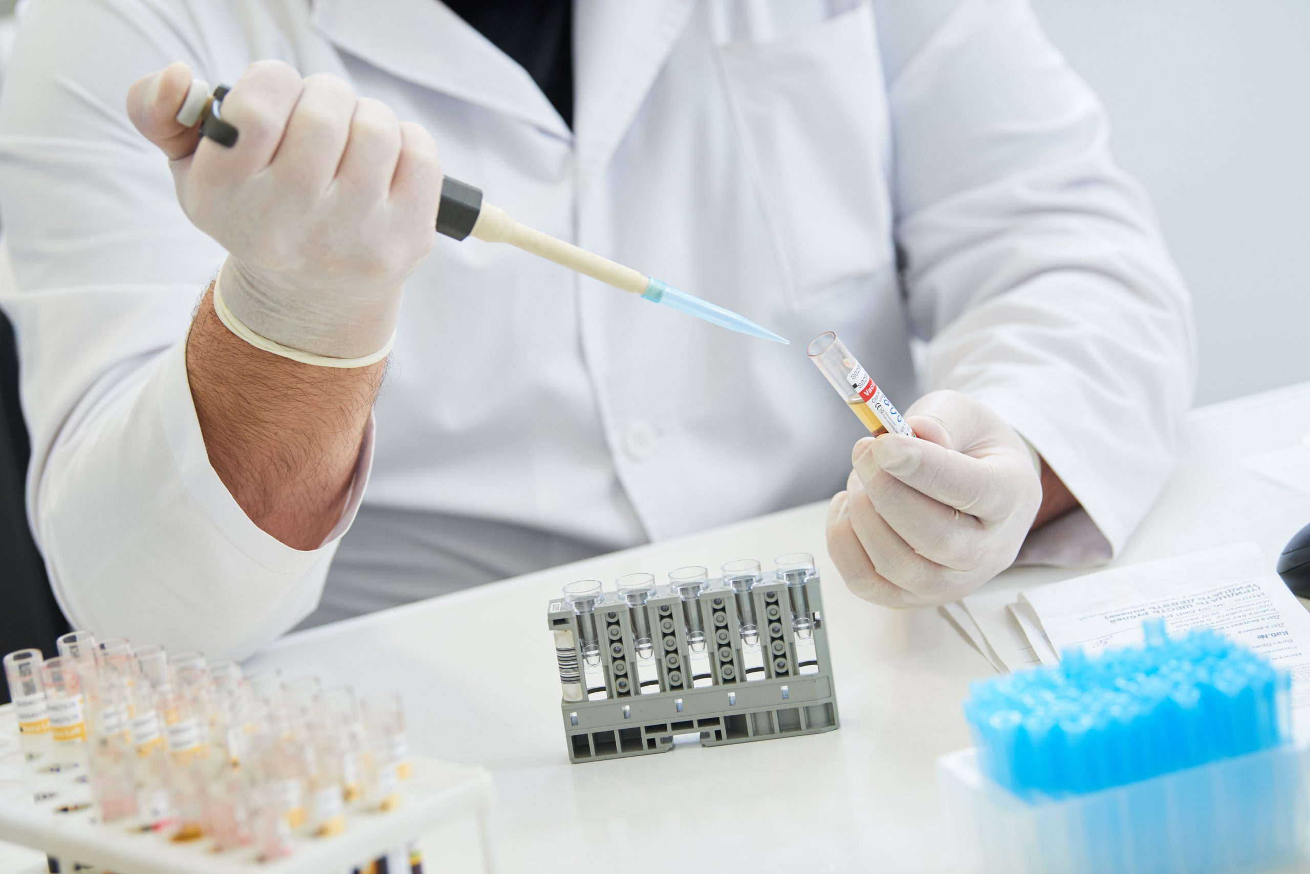 Анализ на паратгормон: ключ к пониманию обмена кальция в организме