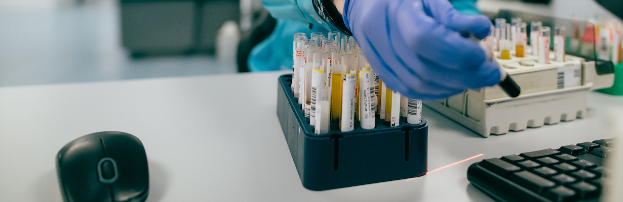 Анализ на АКТГ: ключ к пониманию работы надпочечников и гипофиза