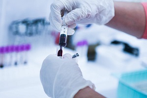 Анализ на альдостерон и ренин: ключ к пониманию причин вашей гипертонии