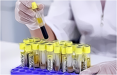Анализ крови на прогестерон для оценки женского и мужского здоровья