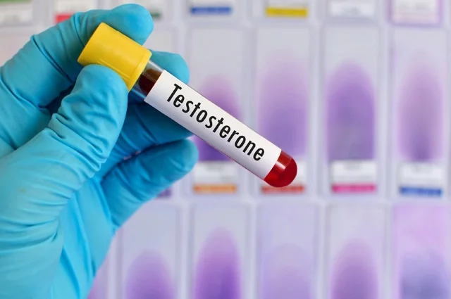 Анализ на тестостерон для оценки гормонального здоровья
