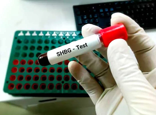 Анализ на ГСПГ: полное руководство по диагностике гормонального баланса