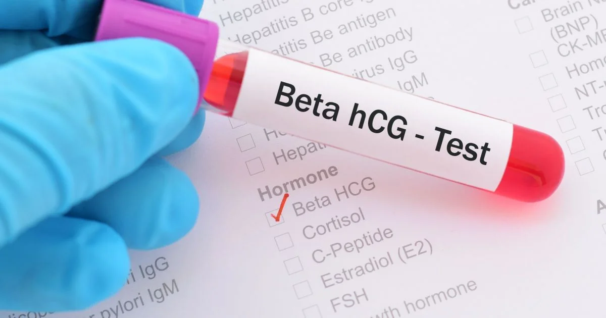 Анализ крови на ХГЧ: полное руководство по диагностике беременности