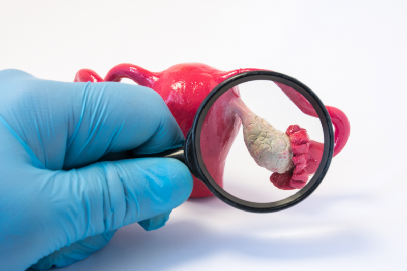 Антимюллеров гормон (АМГ): полное руководство по анализу и его значению