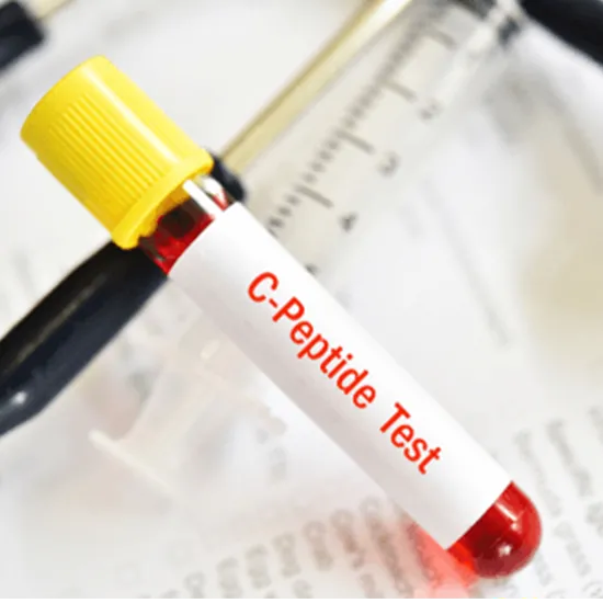 Анализ на инсулин и С-пептид: ключ к оценке углеводного обмена