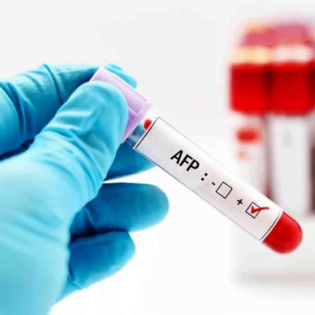 Анализ на альфа-фетопротеин (АФП): полное руководство по онкомаркеру