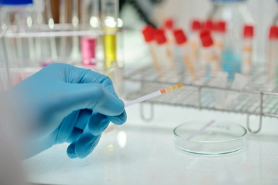 Анализ на антитела к ДНК (anti-dsDNA): ключ к диагностике аутоиммунных заболеваний