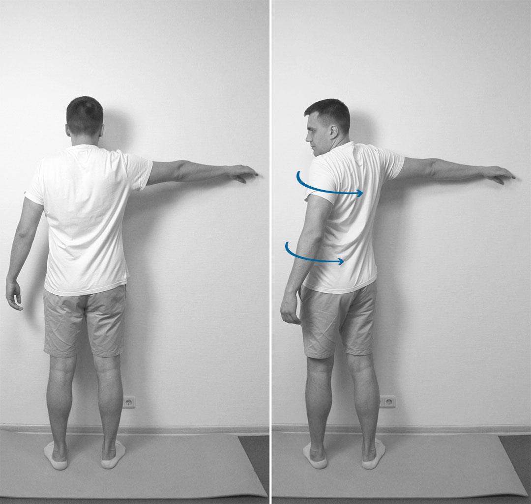 Восстановление подвижности плеча при периартрите с помощью лечебной физкультуры