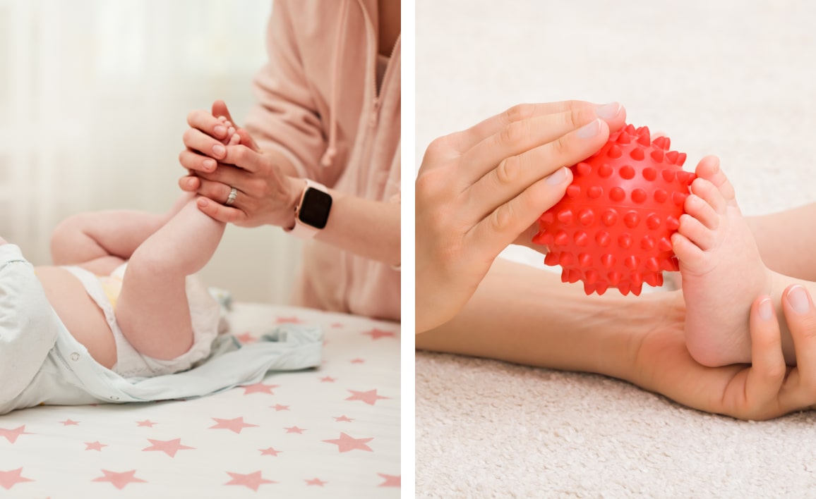 ЛФК при косолапости у детей: вернуть стопам правильное положение